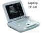 Laptop  Ultrasound Scanner ( Portable Echographie ) Nouveau